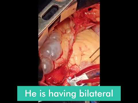 Understanding Valve Diseases
